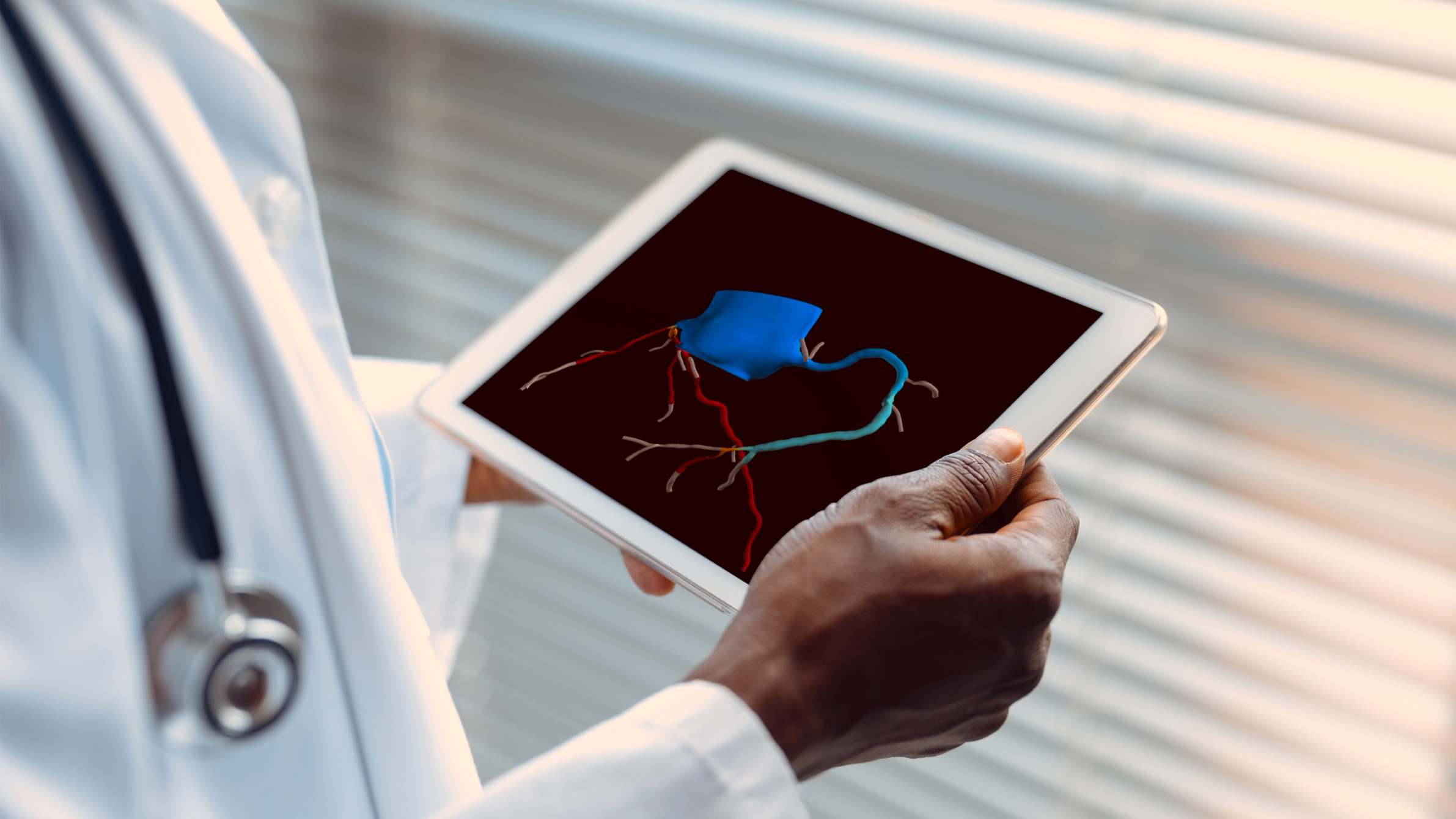 25 1009 REC Heartflow Case Study DoctorIpad